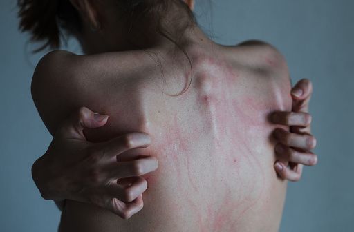 Иллюстрация к словарной статье Abrasions: интерес зрителей к ссадинам и царапинам на коже